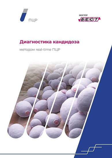 РеалБест ДНК Gardnerella vaginalis (комплект 1)