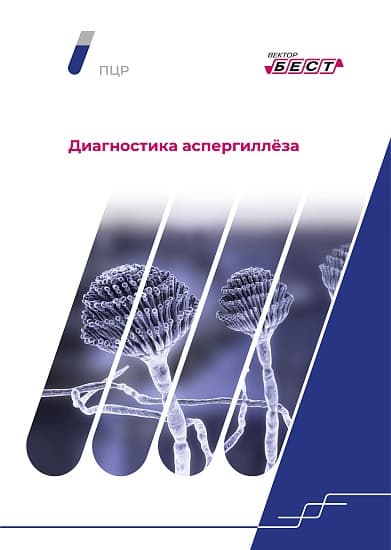 Mycoplasma hominis-IgА-ИФА-БЕСТ