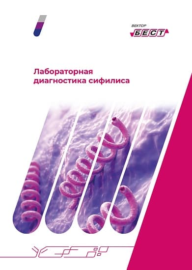 Лямблия-IgM-ИФА-БЕСТ (комплект 2/Чароит)
