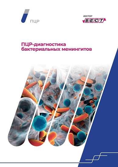 РеалБест-ОРВИ РНК Influenza virus A/B